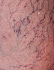 Close up of veins on human skin as background.