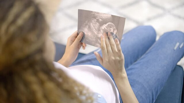 Young expecting female looking at pregnancy scan, dreaming of baby, motherhood