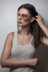 Domestic violence, abuse woman with bruise on face