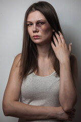 Domestic violence, abuse woman with bruise on face
