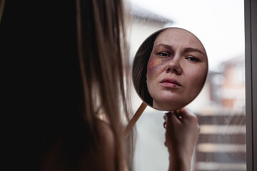 Domestic violence, abuse woman with bruise on face by the window looks in the mirror