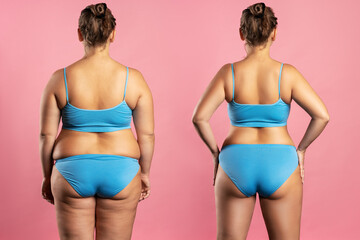 Woman's body before and after weight loss, plastic surgery concept on pink background