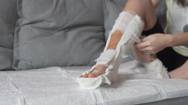 Close-up of tired leg in plaster. The woman removes the bandage and gives her leg in plaster to breathe.