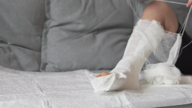 Close-up of the legs in plaster. The woman's hand removes the medical bandage from the plaster languet.