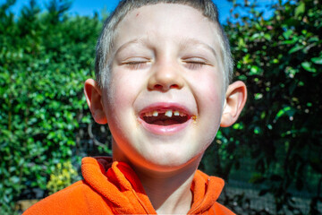 Denti mancanti