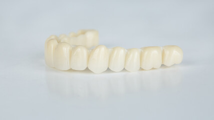 resin upper jaw prosthesis on white background © Dental Pro Content