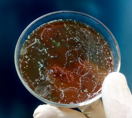 Microbiologist hand hold a Petrie dish with a mixed culture of bacteria. mixed of bacteria colonies