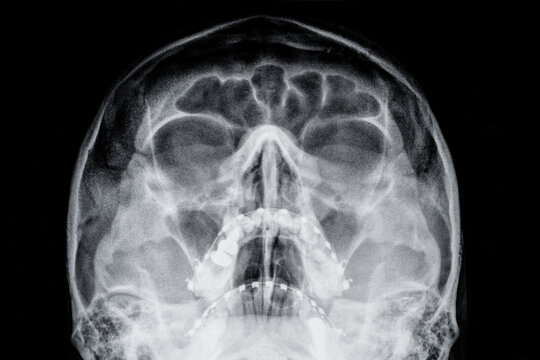 MRI Magnetic resonance image of the human brain and head