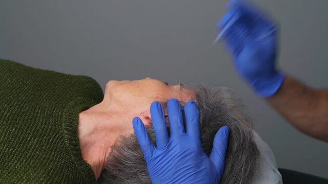 Physical therapy session, using the Dry Needling technique, for a contracture in the temporalis muscle, associated with a temporomandibular joint problem, in a woman with headache and migraines.
