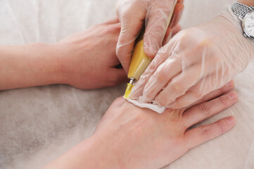Carbon dioxide therapy (carboxytherapy). Carboxytherapy medical procedure.