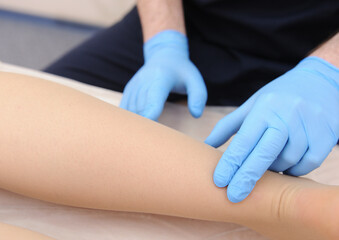 Doctor examines varicose veins on a woman's legs