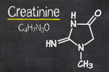 Blackboard with the chemical formula of Creatinine