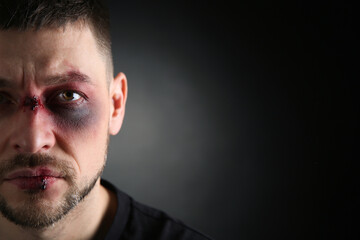 Obraz premium Closeup view of man with facial injuries on dark background, space for text. Domestic violence victim