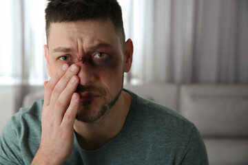 Man with facial injuries at home, space for text. Domestic violence victim