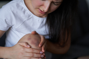 Close-up of a person massaging an injured knee joint. Bruise on the knee. Leg pain