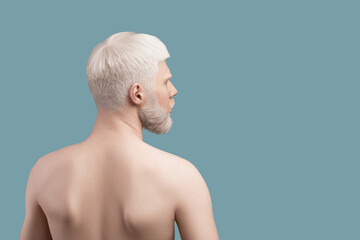 Skin abnormality concept. Back of thin albino young man, posing in studio over turquoise background, looking aside