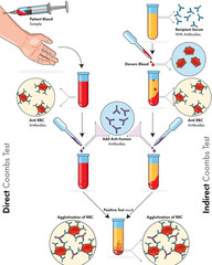 illustration of Coombs test of immunology: blood test experiment.