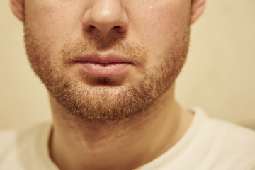 The beard of a light blond-haired man.