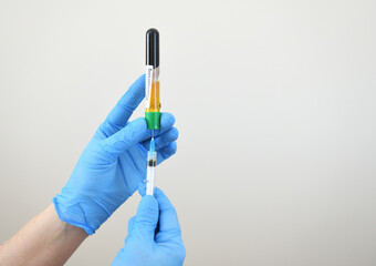  Plasma lifting - close-up of a doctor's hand in blue rubber gloves with a syringe. Plasmolifting...