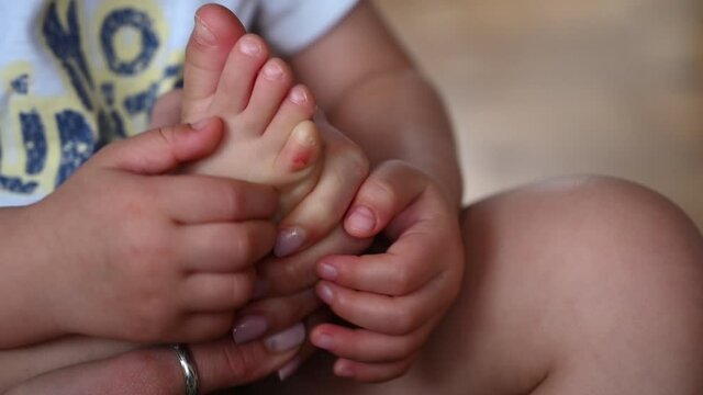 Injured leg of the child, abrasions in the child. Callus on the toe