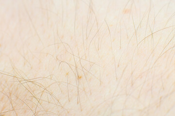 Human skin with hairs texture background. Macro photo, close up.