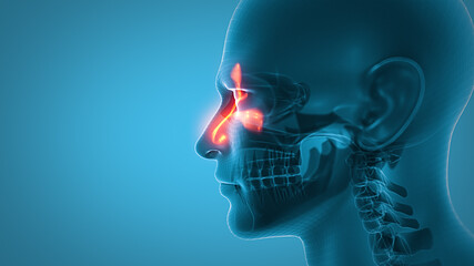 3d illustration of human head whith sinusitis.