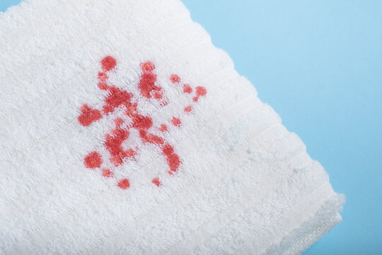 stains blood on a white towel. daily life dirty stain for wash and clean concept