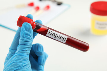 Obraz premium Doctor holding test tube with blood sample over table, closeup. Doping control