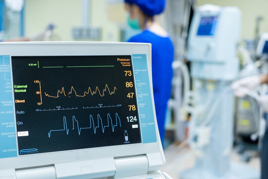 EKG monitor in intra aortic balloon pump machine. Medical equipment.