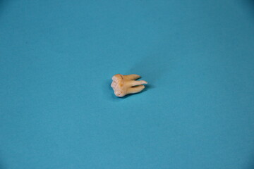 Extracted wisdom tooth on blue background, close-up