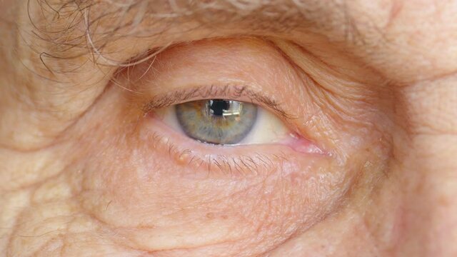 The eye of a very old man, close-up.