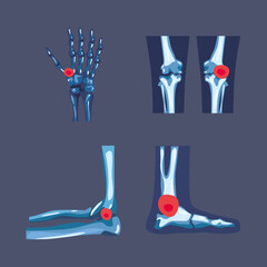 Rheumatology symbol set