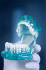 Dental tooth implant model