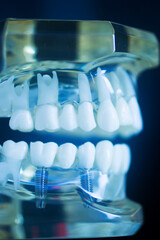 Dental tooth implant model