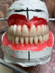 Denture model