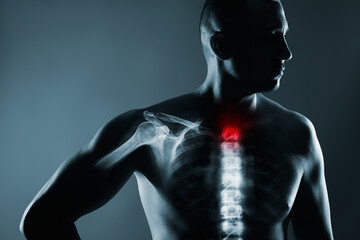 Fototapeta na wymiar Human spine in x-ray on gray background.