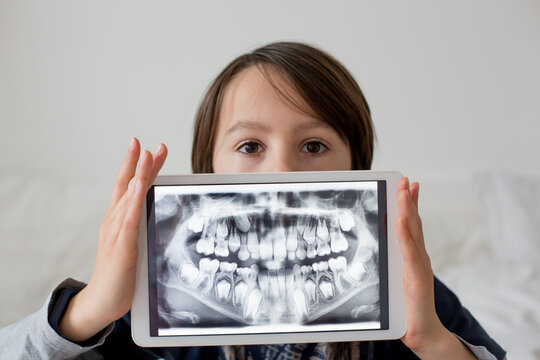 Child, preteen boy, holding tablet with a picture of his x-ray teeth