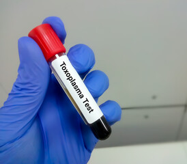 Test tube with blood sample for Toxoplasma test