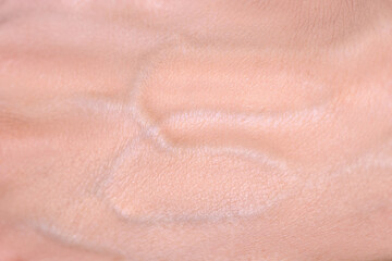 Fototapeta premium Veins on the arm close-up