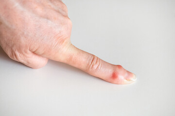 Sick female fingers of an elderly man's hands on a white background