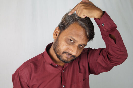 Indian Man Showing His White Hair And Hair Loss Problem At A Young Age