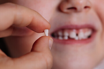 close-up the thumb and index finger hold the fallen or removed baby tooth, the front incisor with the blurred toothless mouth of the child in the background.