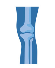normal knee bones