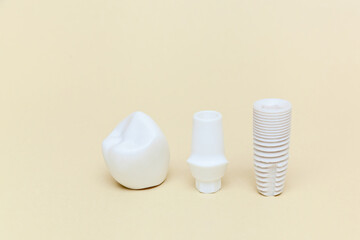 Dental implant. Dental implant model of artificial tooth