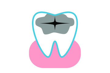 むし歯のイラスト