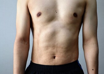 Fototapeta premium ダイエットに成功した日本人男性