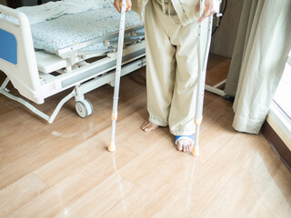 Fototapeta na wymiar A male patient in splint walking with crutches in hospital, step forward walk with crutches for injured leg or leg splint. healthcare concept