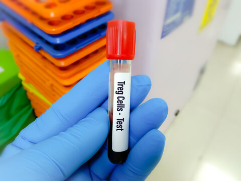 Test Tube With Blood Sample For Treg Cells Test, Regulatory T Cell