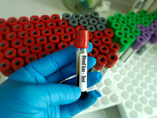 blood specimen i tube for blood gas test measures the acidity and the levels of oxygen and carbon...
