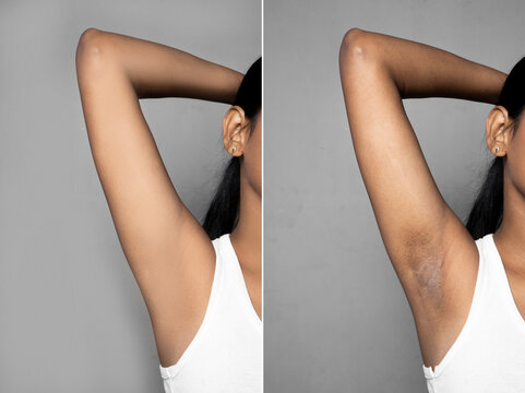 Underarm Women Images Browse 28 979 Stock Photos Vectors and